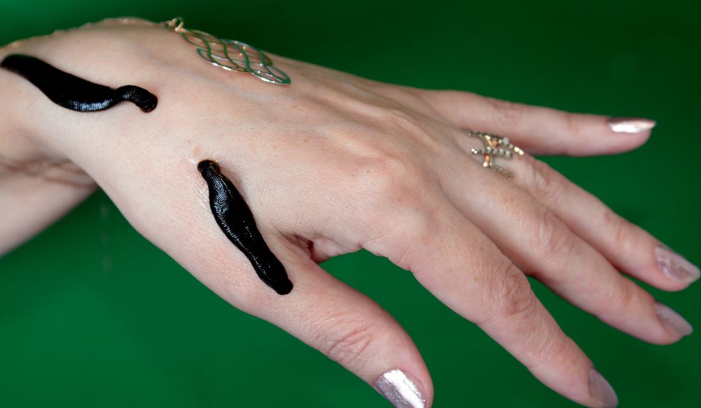 Лечение медецинскими пиявками в Самарканде